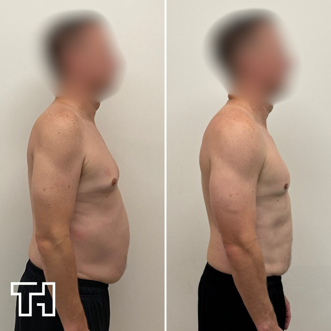 Client transformation showing body composition changes