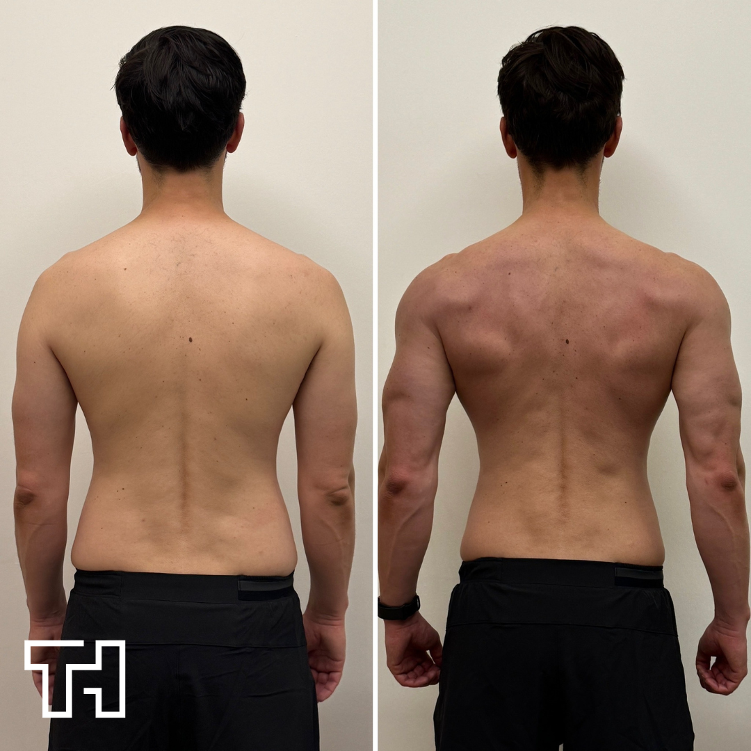 Client transformation showing back muscle development