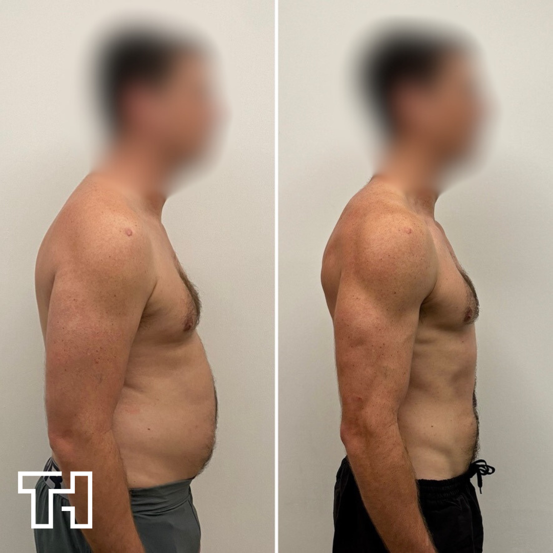 Client transformation showing body composition changes
